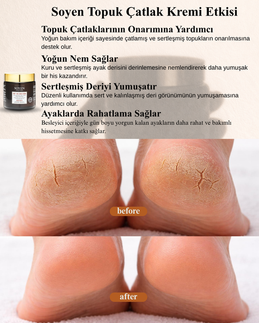Soyen Ayak Bakım Kremi – Yoğun Nemlendirici & Onarıcı Bakım (100 ml)