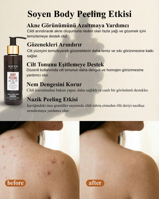 Soyen Vücut Peeling Kremi – AHA Etkili Peeling ile Arındırıcı ve Yenileyici Bakım (150 ml)