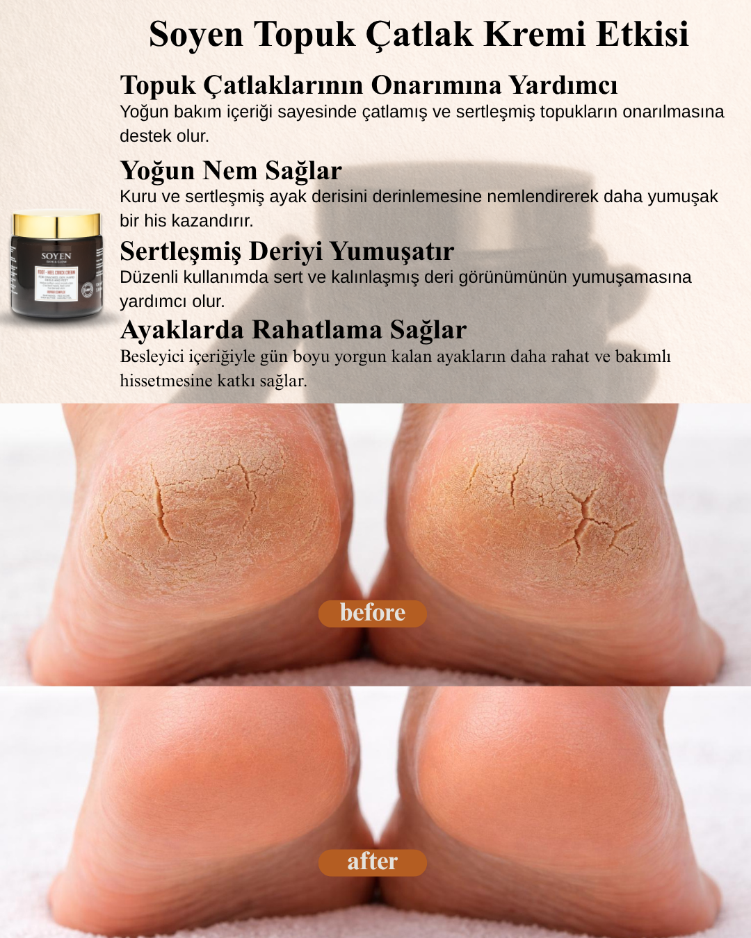 Soyen Ayak Bakım Kremi – Yoğun Nemlendirici & Onarıcı Bakım (100 ml)