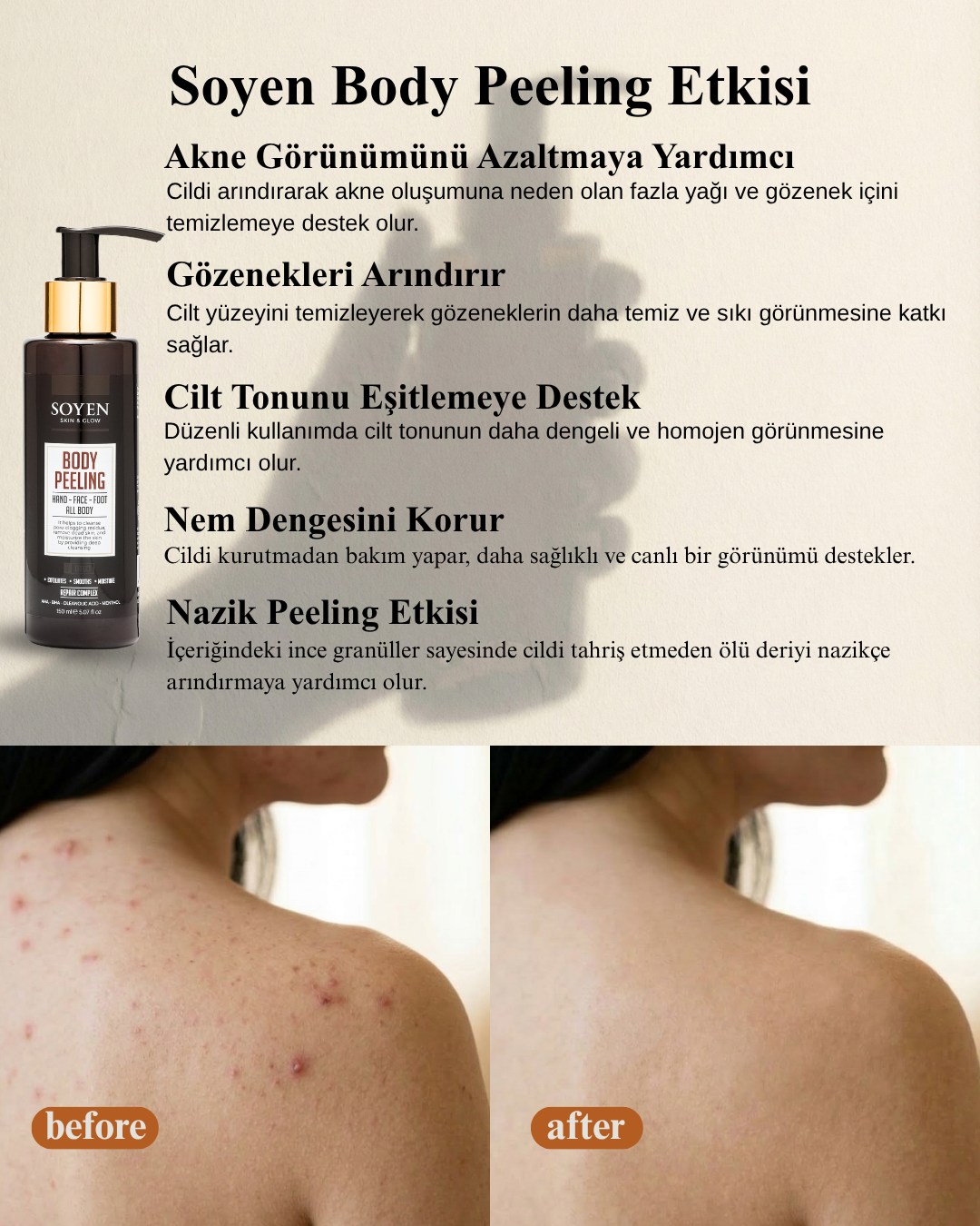 Soyen Vücut Peeling Kremi – AHA Etkili Peeling ile Arındırıcı ve Yenileyici Bakım (150 ml)
