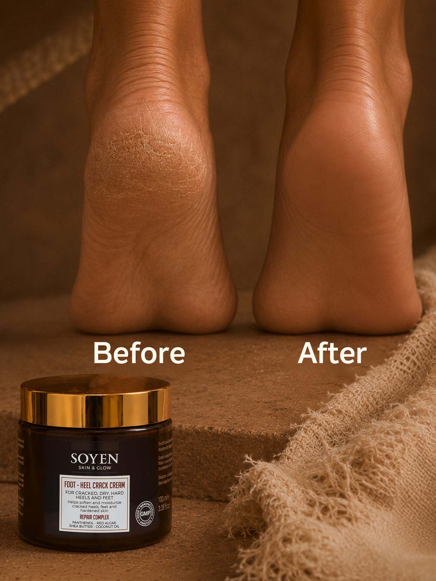 Soyen Ayak Bakım Kremi – Yoğun Nemlendirici & Onarıcı Bakım (100 ml)